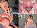 【HD】【個人撮影】谷田かりな　開口器で口内観察デカ舌を要チェック